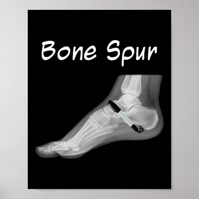 Trump Bone Spur Ink Pen Funny Anti Trump  Poster (Front)