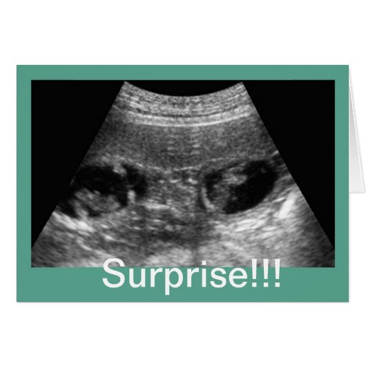 Twins Ultrasound Cards (Front Horizontal)