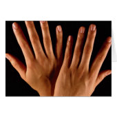 Two crossed hands (Front Horizontal)