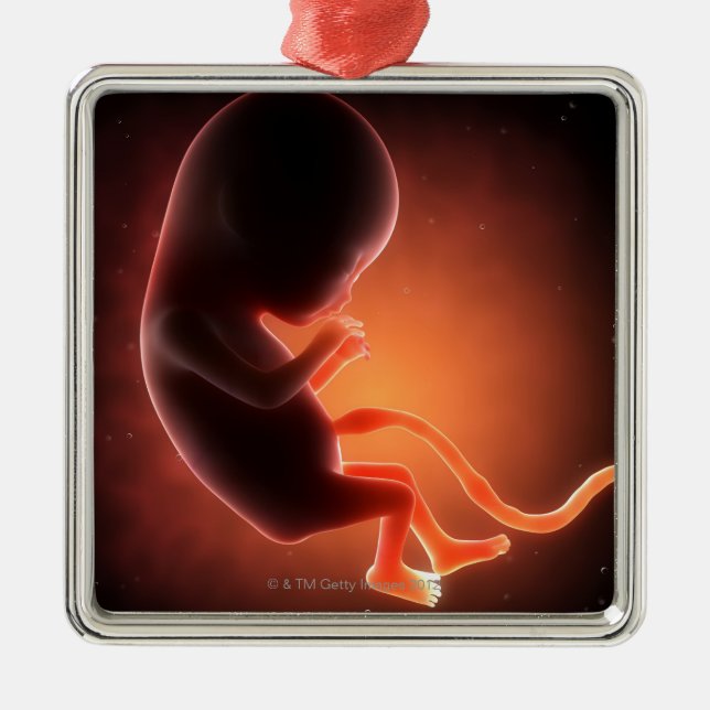 Two Month Old Fetus Metal Ornament (Front)