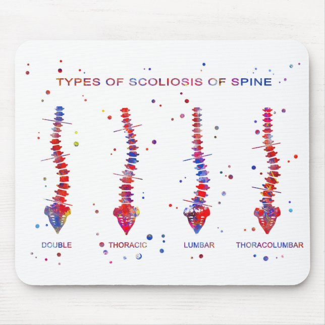Type of scoliosis of spine mouse pad (Front)