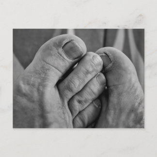 Ugly Feet Postcard
