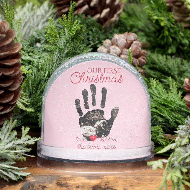 Ultrasound 1st Christmas Pregnancy Announcement Snow Globe (Winter)