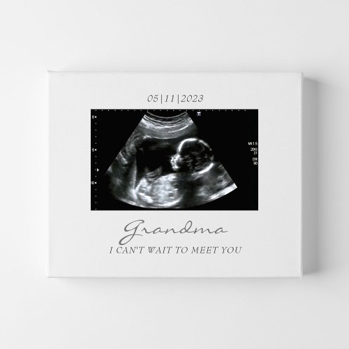 Ultrasound Gift for Grandma New Baby Announcement Faux Canvas Print