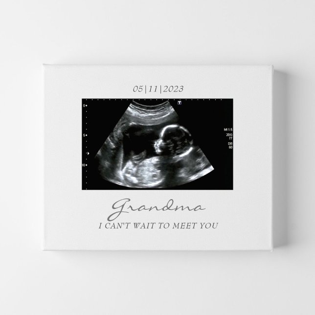Ultrasound Gift for Grandma New Baby Announcement Faux Canvas Print (baby announcement ultrasound picture for grandma
)
