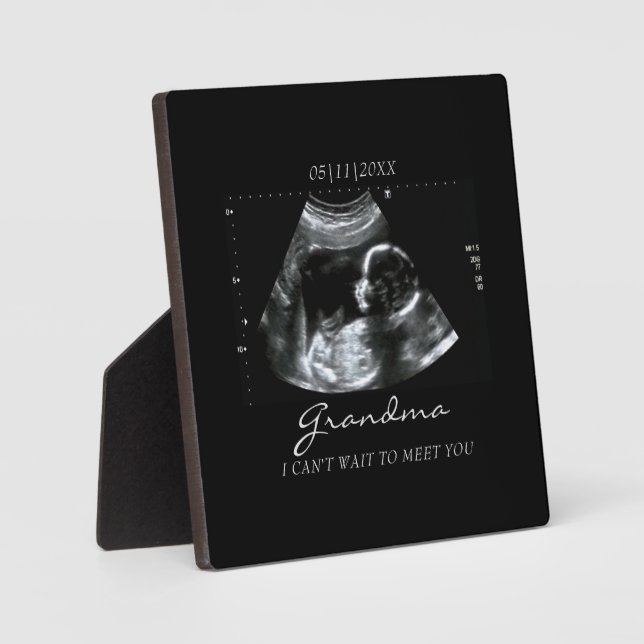 Ultrasound Gifts for Grandma Sonogram Baby Photo Plaque (Front)