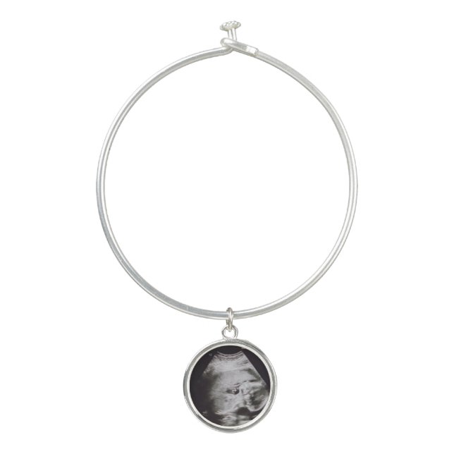 Ultrasound keepsake baby gift bracelet (Front)