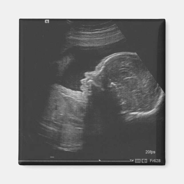 Ultrasound Magnet (Front)