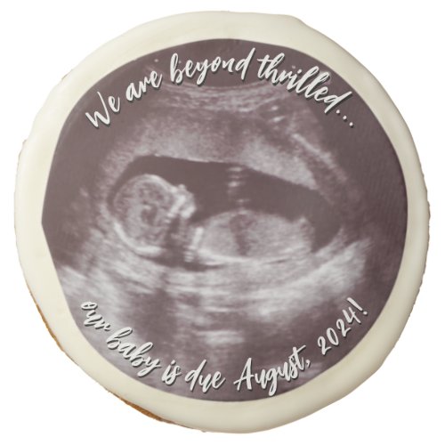 Ultrasound or Sonogram Photo Baby Announcement Sugar Cookie
