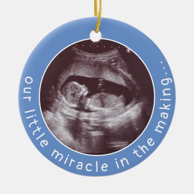 Ultrasound Photo Baby Boy Blue Miracle in Making Ceramic Ornament (Front)
