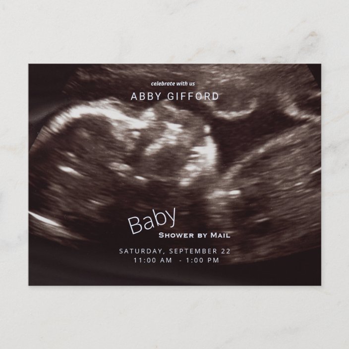Ultrasound Photo Baby Shower by Mail Blue Invitation Postcard | Zazzle