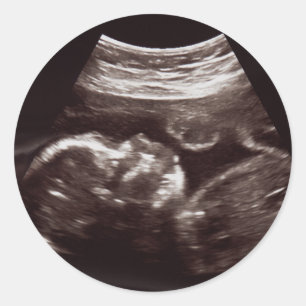 Ultrasound Photo Baby Shower Thank You Seal