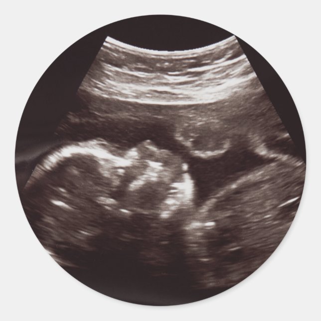 Ultrasound Photo Baby Shower Thank You Seal (Front)