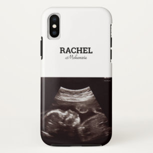 Ultrasound Photo Black and White Monogram iPhone X Case