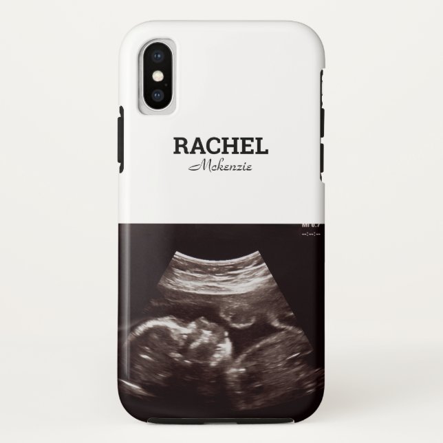 Ultrasound Photo Black and White Monogram Case-Mate iPhone Case (Back)