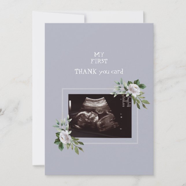 Ultrasound Photo Girl Thank You Baby Point of View Card (Front)