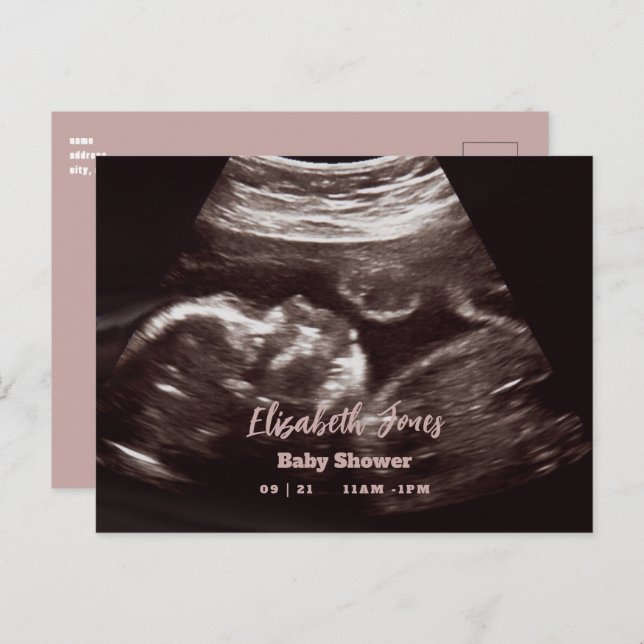 Ultrasound Photo Pink Baby Shower Announcement Postcard (Front/Back)