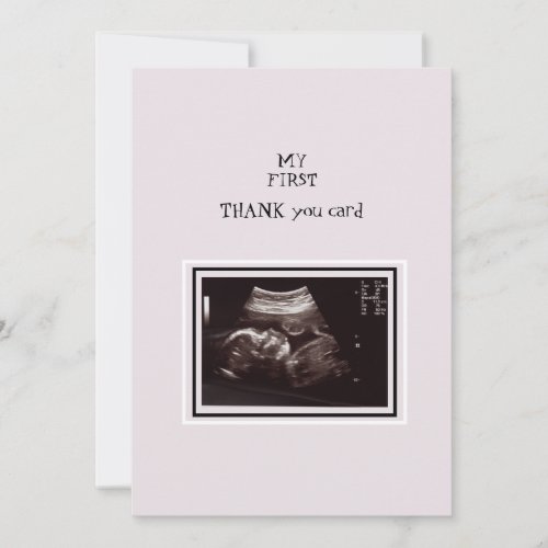 Ultrasound Photo Pink Thank You Baby
