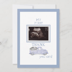 Ultrasound Photo Truck Thanks Blue Baby Viewpoint Thank You Card