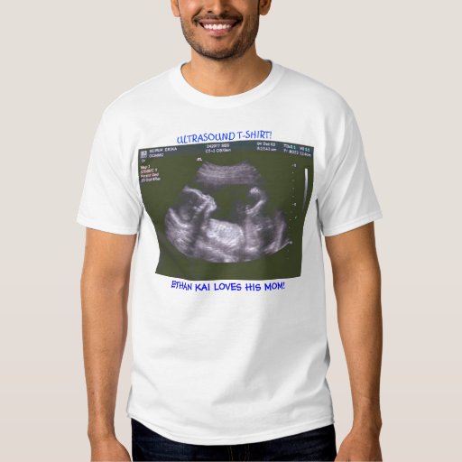 Ultrasound T-Shirt | Zazzle