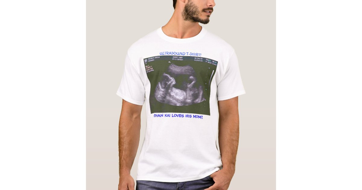 Ultrasound TShirt Zazzle