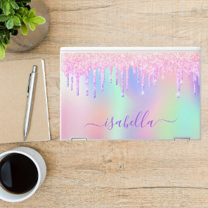 Unicorn glitter pink rose gold rainbow holographic HP laptop skin