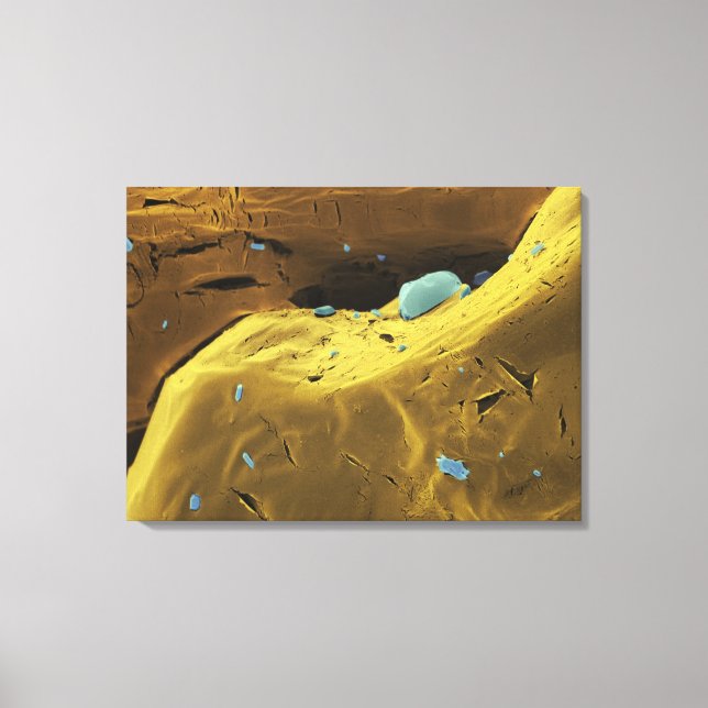 Urea powder canvas print (Front)