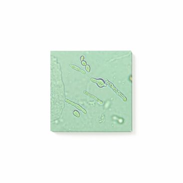 Urinalysis Yeast Microscope Laboratory Slide Post-it Notes