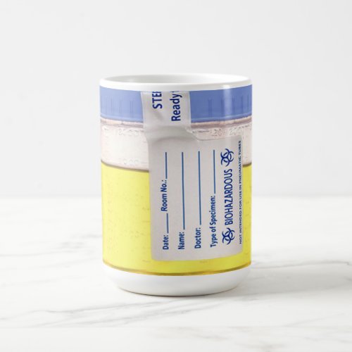 Urine Specimen Coffee Mug