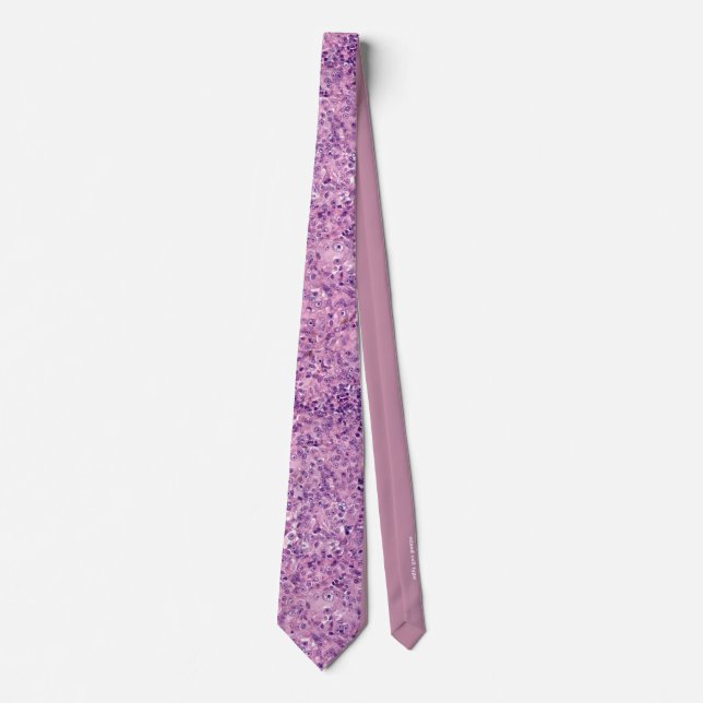 Uveal melanoma mixed cell type neck tie (Front)