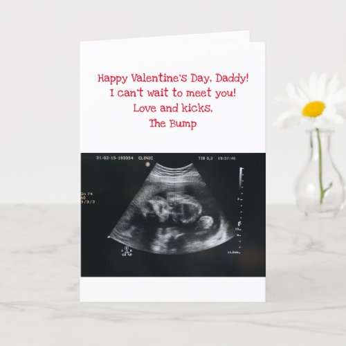 Valentines Day card from the bump unborn baby