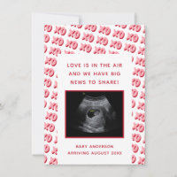 Valentine's Day Ultrasound Pregnancy Reveal