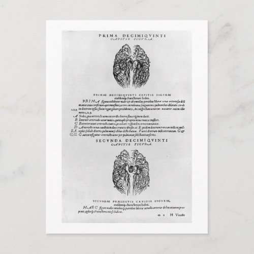 Vascular system of the brain postcard