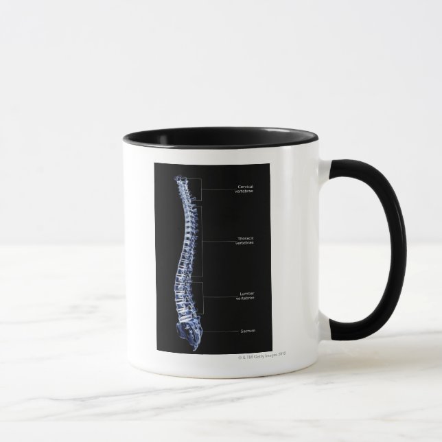 Vertebral Column 4 Mug (Right)