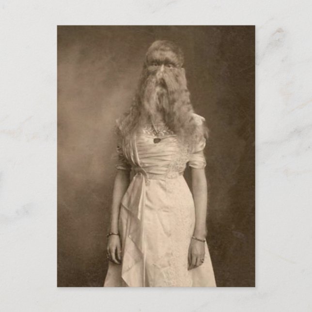 Victorian Weird a Woman Facial Hair Postcard (Front)