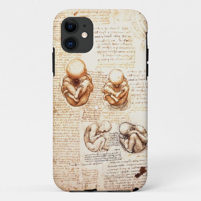 Views of a Fetus in the Womb,Ob-Gyn Medical Case-Mate iPhone Case (Back)
