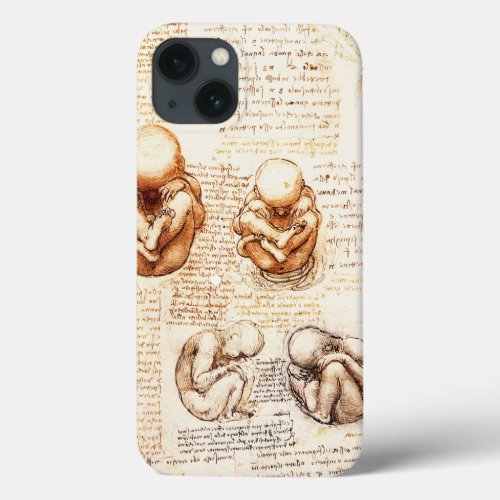 Views of a Fetus in the WombOb_Gyn Medical iPhone 13 Case