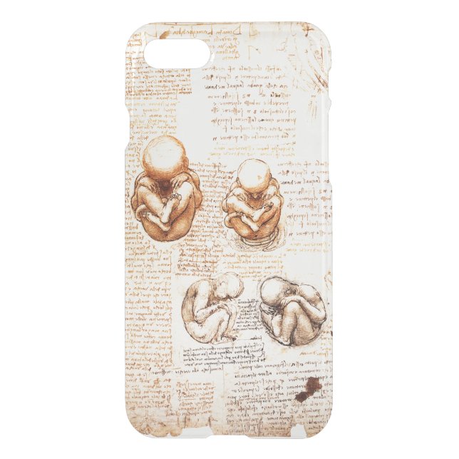 Views of a Fetus in the Womb,Ob-Gyn Medical Uncommon iPhone Case (Back)