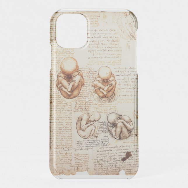 Views of a Fetus in the Womb,Ob-Gyn Medical Uncommon iPhone Case (Back)