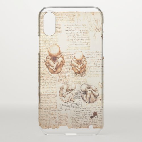 Views of a Fetus in the WombOb_Gyn Medical iPhone XS Case