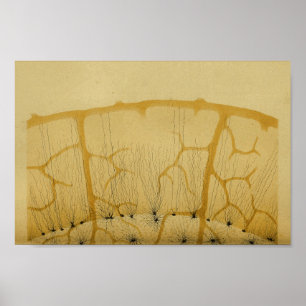 Vintage 1886 Central Nervous System Nerves Poster