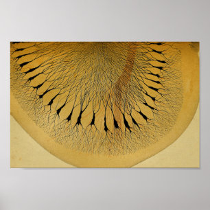 Vintage 1886 Central Nervous System Nerves Poster