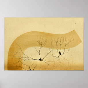 Vintage 1886 Central Nervous System Nerves Poster
