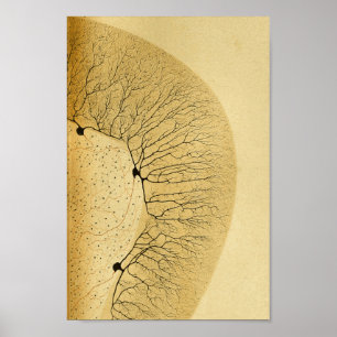 Vintage 1886 Central Nervous System Nerves Poster