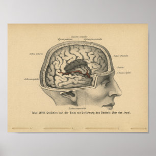 Vintage 1888 German Anatomy Print Skull Brain