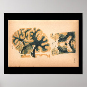 Vintage 1901 Brain Anatomy Print