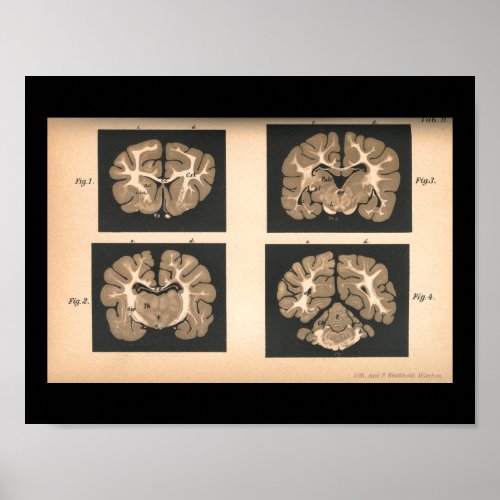 Vintage 1901 Brain Anatomy Print