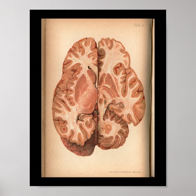 Vintage 1901 Brain Anatomy Print (Front)
