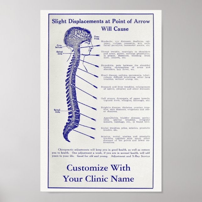Vintage 1921 Chiropractic Ad Art Poster Customize (Front)