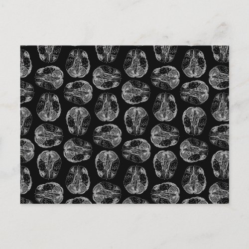 Vintage Brain Diagram Print Pattern Brains Black Postcard